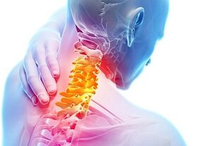 Principalele semne și simptome ale osteochondrozei cervicale