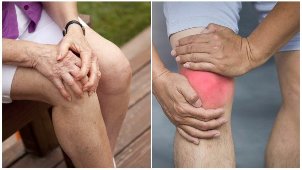 simptomele osteoartrita