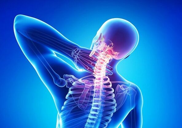 durere la nivelul coloanei cervicale cu osteocondroză