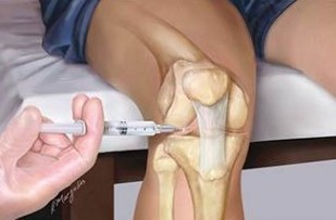 Injecție în plus