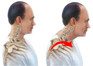 sănătos și bolnav coloanei vertebrale